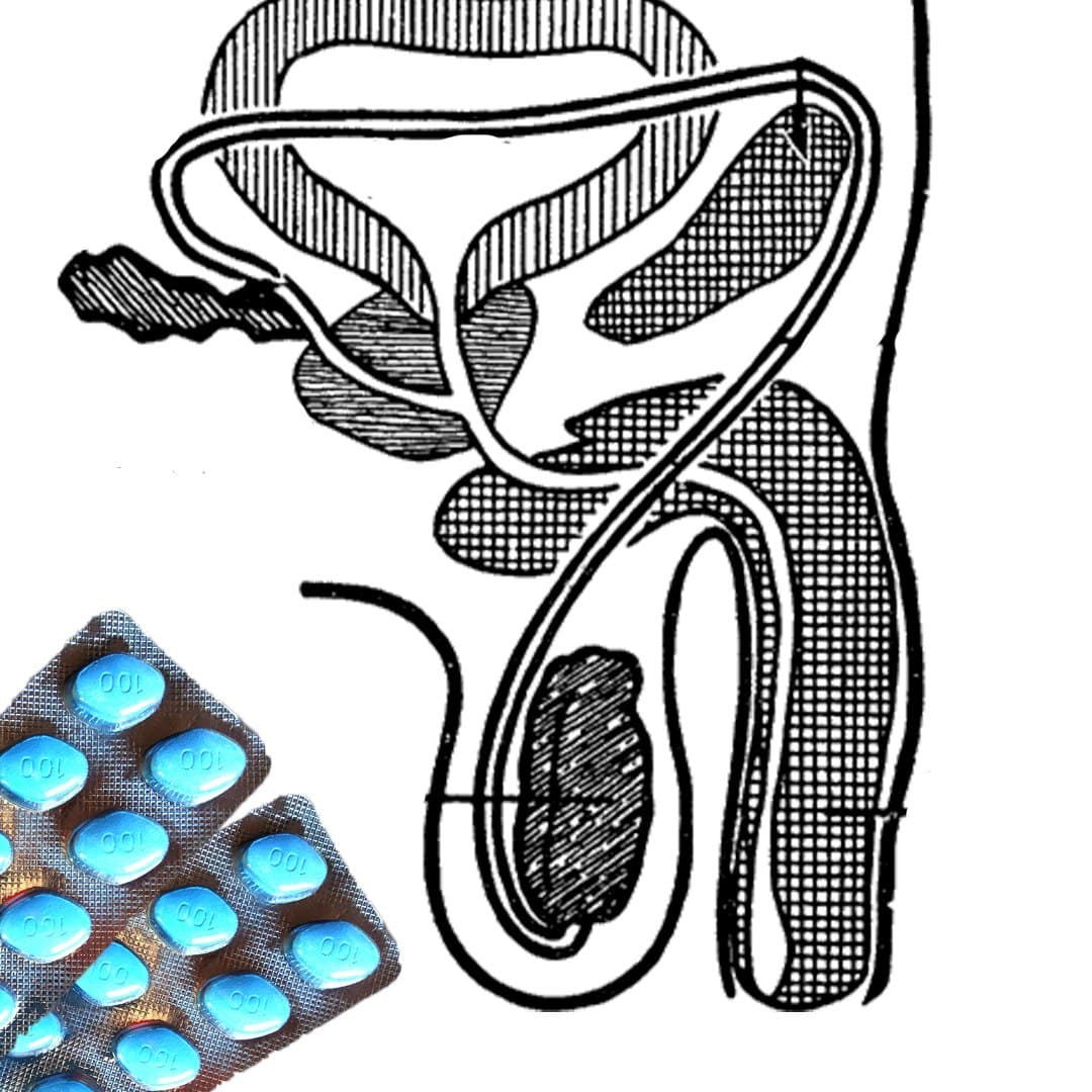 Ο γιατρός μιλάει για τη θεραπεία της προστατίτιδας